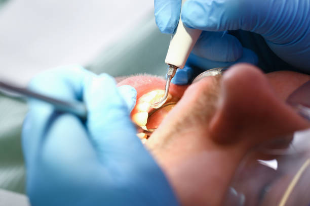 Best Emergency Root Canal Treatment in Huntland, TN